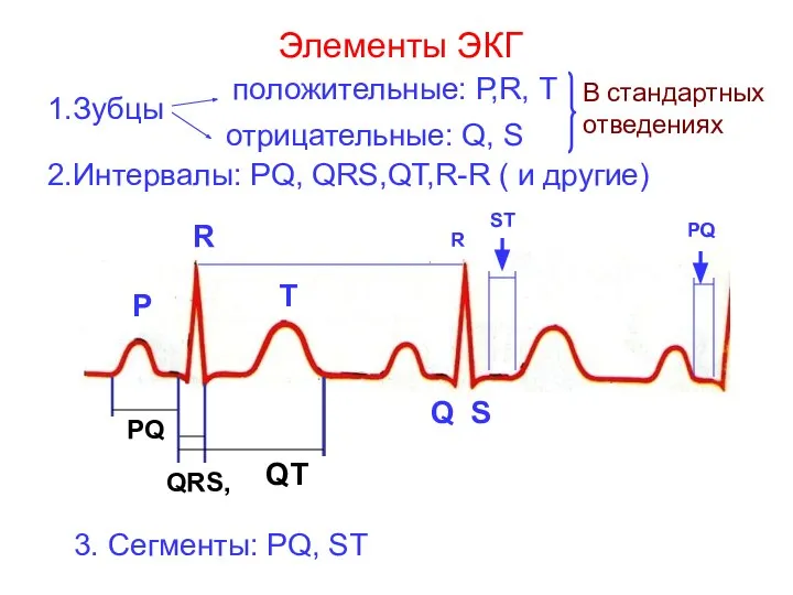 Элементы ЭКГ 1.Зубцы положительные: Р,R, Т отрицательные: Q, S В стандартных отведениях