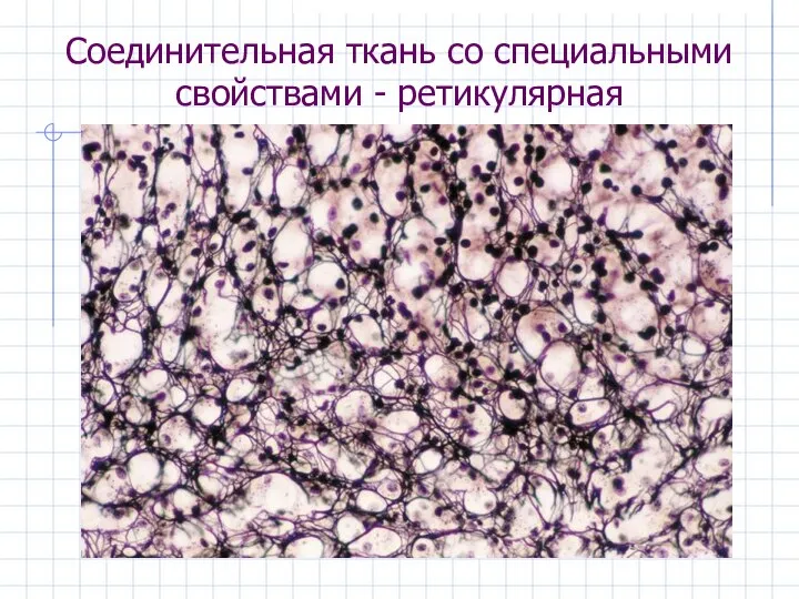 Соединительная ткань со специальными свойствами - ретикулярная