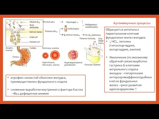 Аутоиммунные процессы Образуются антитела к париетальным клеткам фундальных желез желудка ↓ HCL,