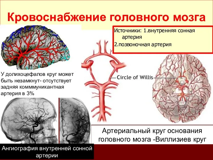 Артериальный круг основания головного мозга -Виллизиев круг Ангиография внутренней сонной артерии У