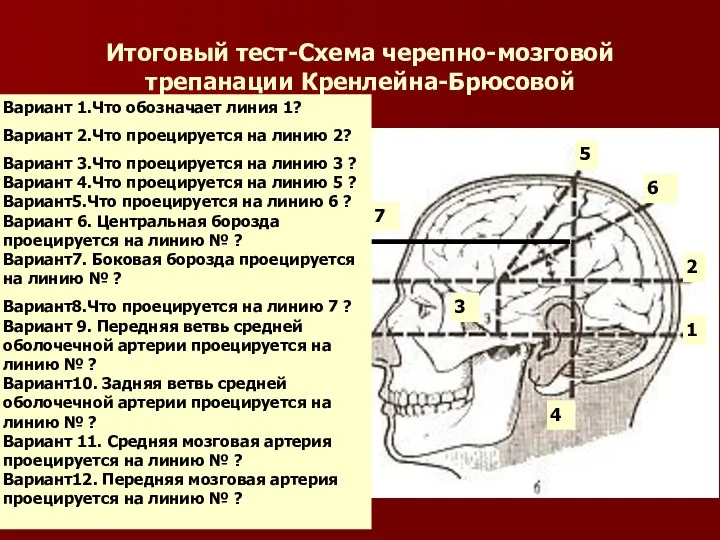 Итоговый тест-Схема черепно-мозговой трепанации Кренлейна-Брюсовой Вариант 1.Что обозначает линия 1? Вариант 2.Что