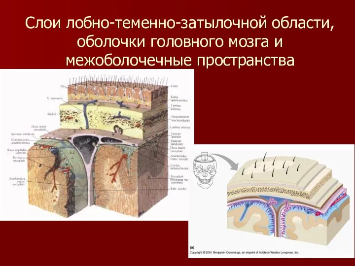 Слои лобно-теменно-затылочной области, оболочки головного мозга и межоболочечные пространства