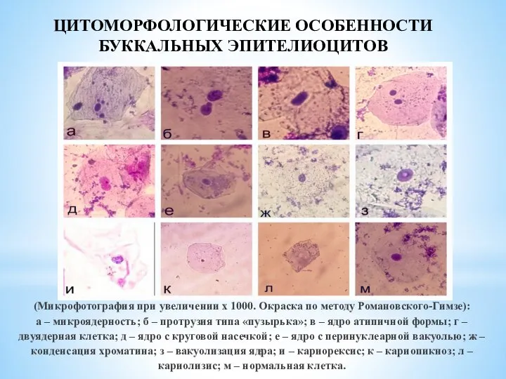 (Микрофотография при увеличении х 1000. Окраска по методу Романовского-Гимзе): а – микроядерность;