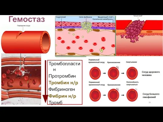 Гемостаз Тромбопластин Протромбин Тромбин н/р Фибриноген Фибрин н/р Тромб