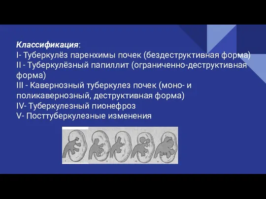 Классификация: I- Туберкулёз паренхимы почек (бездеструктивная форма) II - Туберкулёзный папиллит (ограниченно-деструктивная