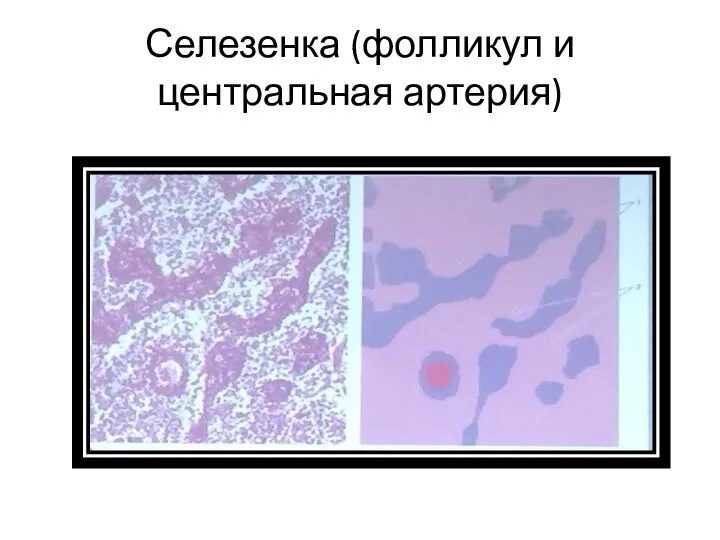 Селезенка (фолликул и центральная артерия)