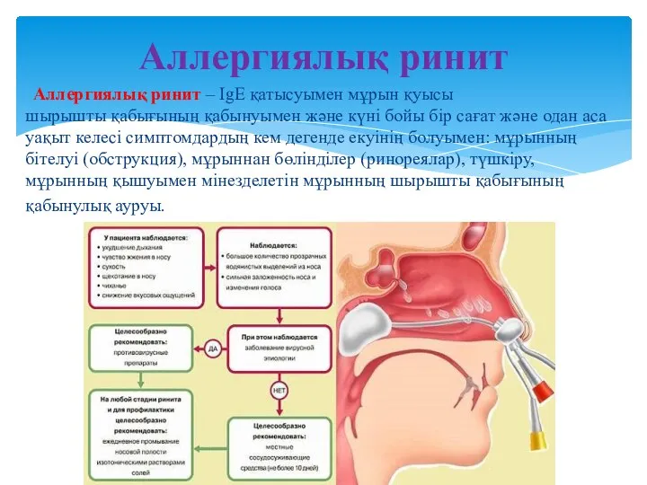 Аллергиялық ринит – IgE қатысуымен мұрын қуысы шырышты қабығының қабынуымен жəне күні