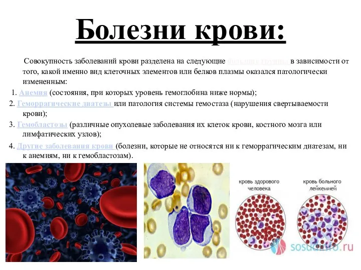 Болезни крови: Совокупность заболеваний крови разделена на следующие большие группы в зависимости