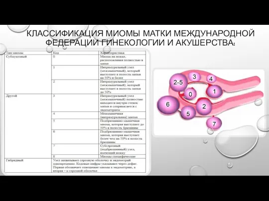 КЛАССИФИКАЦИЯ МИОМЫ МАТКИ МЕЖДУНАРОДНОЙ ФЕДЕРАЦИИ ГИНЕКОЛОГИИ И АКУШЕРСТВА: