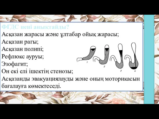 ФГДС нені анықтайды? Асқазан жарасы және ұлтабар ойық жарасы; Асқазан рагы; Асқазан