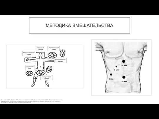 МЕТОДИКА ВМЕШАТЕЛЬСТВА Мерсаидова К.И., Прудков М.И., Нишневич Е.В., Багин В.А., Тарасов Е.Е.,