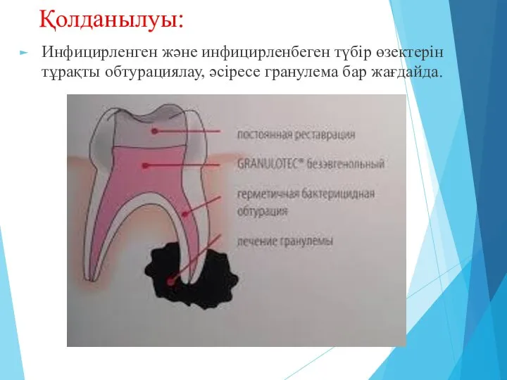 Қолданылуы: Инфицирленген және инфицирленбеген түбір өзектерін тұрақты обтурациялау, әсіресе гранулема бар жағдайда.