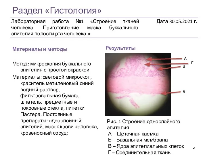 Раздел «Гистология» Материалы и методы Результаты Метод: микроскопия буккального эпителия с простой