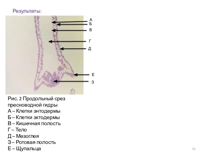 Результаты: А Рис. 2 Продольный срез пресноводной гидры А – Клетки энтодермы