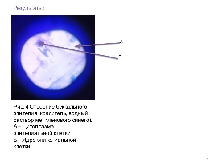 Результаты: А Б Рис. 4 Строение буккального эпителия (краситель, водный раствор метиленового