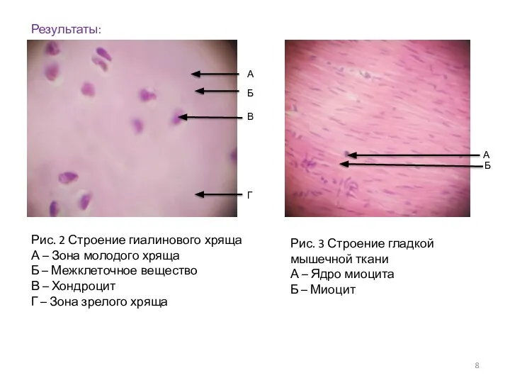 Результаты: Рис. 2 Строение гиалинового хряща А – Зона молодого хряща Б