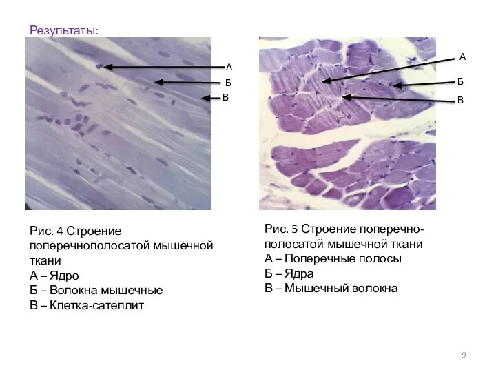 Результаты: Рис. 4 Строение поперечнополосатой мышечной ткани А – Ядро Б –