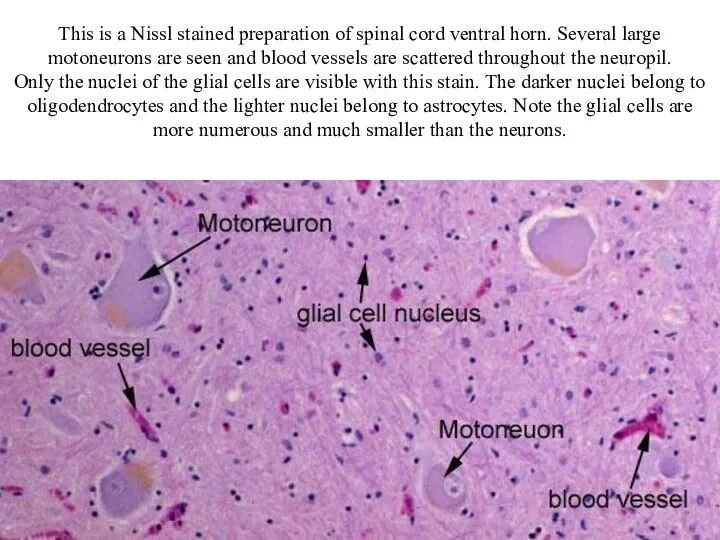 This is a Nissl stained preparation of spinal cord ventral horn. Several