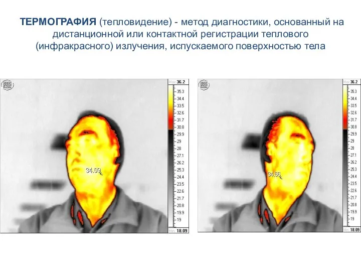 ТЕРМОГРАФИЯ (тепловидение) - метод диагностики, основанный на дистанционной или контактной регистрации теплового