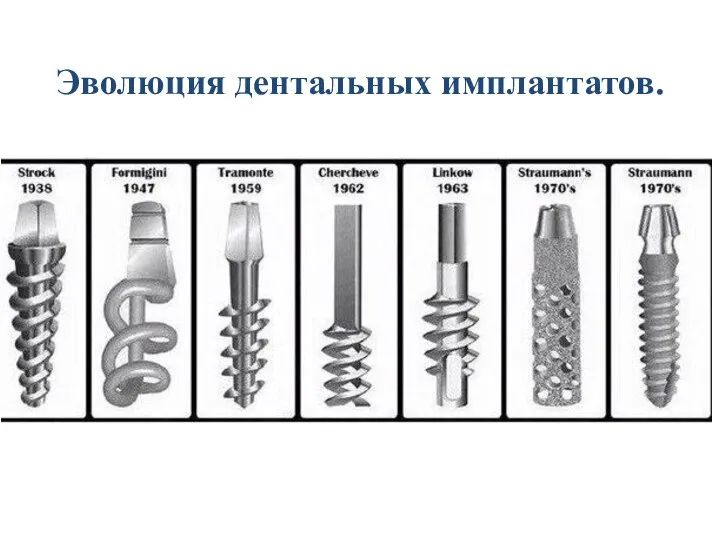 Эволюция дентальных имплантатов.