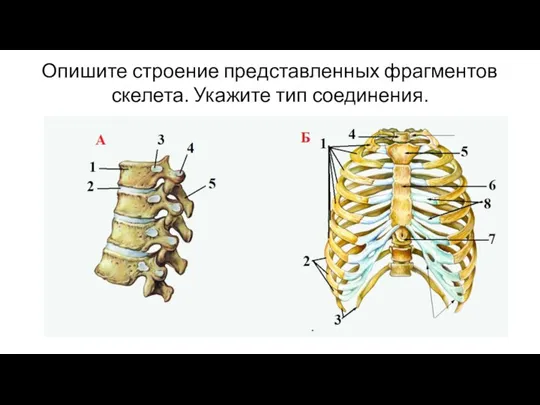 Опишите строение представленных фрагментов скелета. Укажите тип соединения.