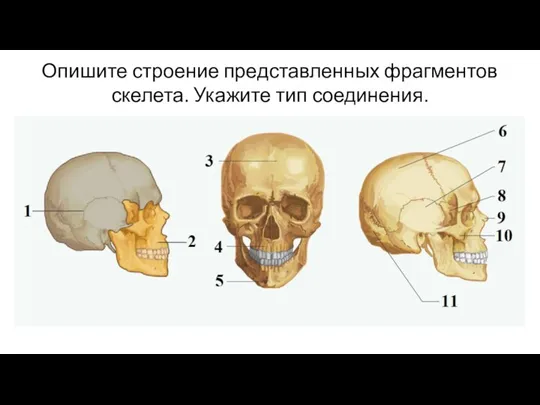 Опишите строение представленных фрагментов скелета. Укажите тип соединения.