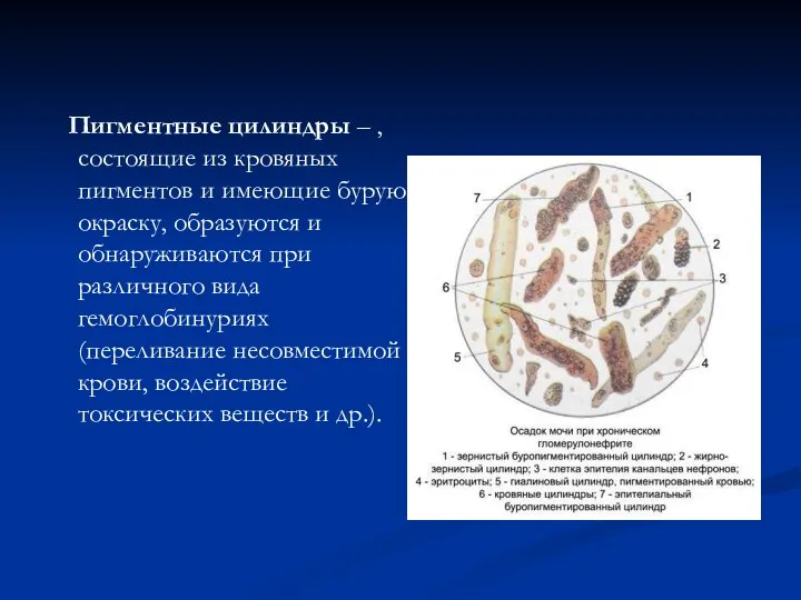 Пигментные цилиндры – , состоящие из кровяных пигментов и имеющие бурую окраску,