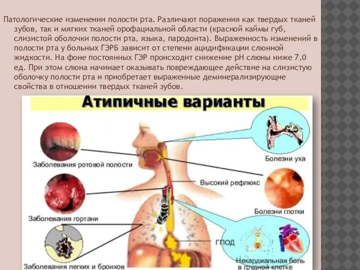 Патологические изменении полости рта. Различают поражения как твердых тканей зубов, так и