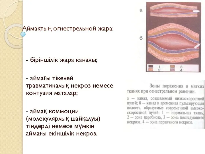 Аймақтың огнестрельной жара: - біріншілік жара каналы; - аймағы тікелей травматикалық некроз