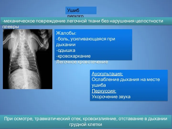 Ушиб легкого -механическое повреждение легочной ткани без нарушения целостности плевры При осмотре,