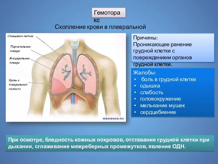 Гемоторакс Скопление крови в плевральной полости Причины: Проникающее ранение грудной клетки с