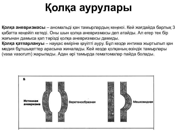 Қолқа аурулары Қолқа аневризмасы – аномальді қан тамырлардың кеңеюі. Кей жағдайда барлық