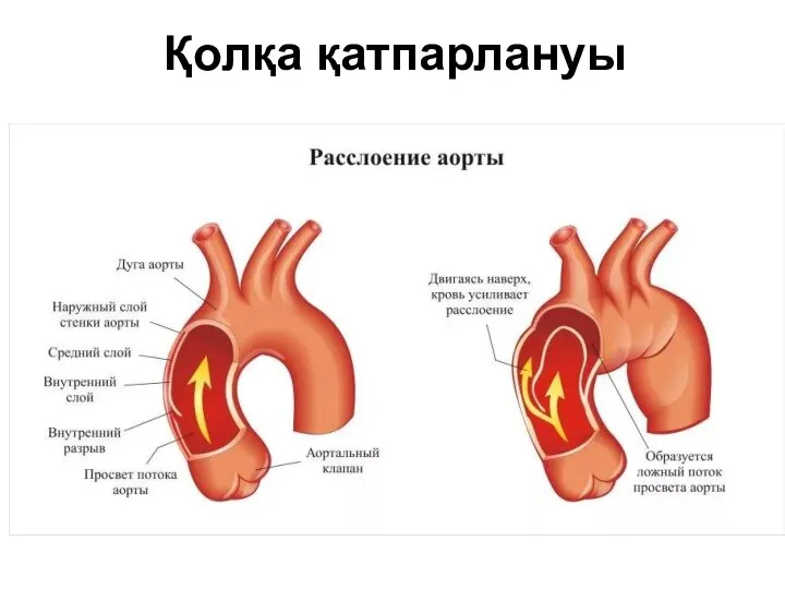 Қолқа қатпарлануы