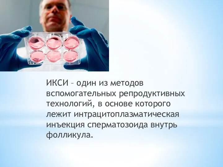 ИКСИ – один из методов вспомогательных репродуктивных технологий, в основе которого лежит