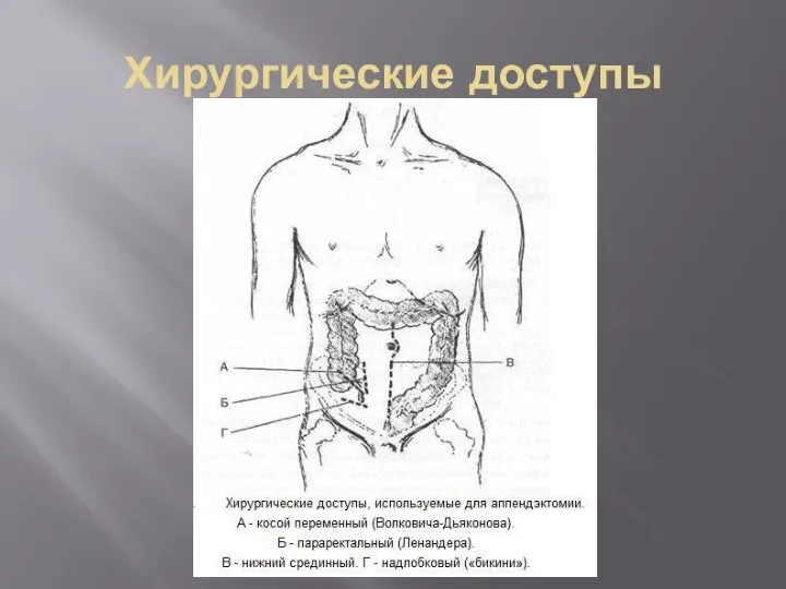 Хирургические доступы