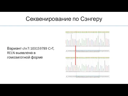 Секвенирование по Сэнгеру Вариант chr7:103159789 C>T, RELN выявлена в гомозиготной форме