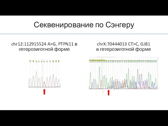 Секвенирование по Сэнгеру chrX:70444013 CT>C, GJB1 в гетерозиготной форме chr12:112915524 A>G, PTPN11 в гетерозиготной форме