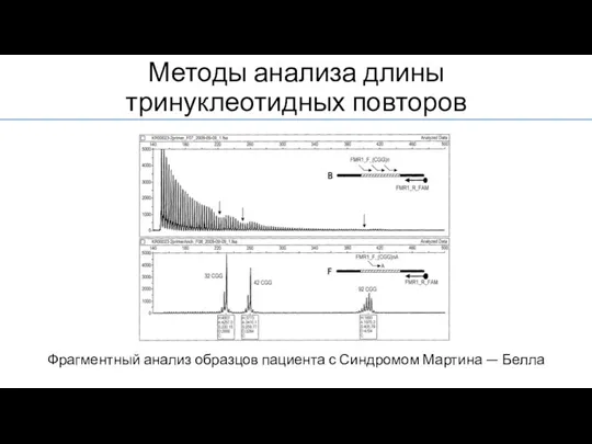 Методы анализа длины тринуклеотидных повторов Фрагментный анализ образцов пациента с Синдромом Мартина — Белла