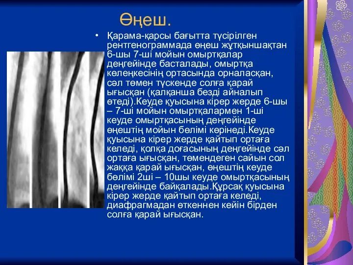 Өңеш. Қарама-қарсы бағытта түсірілген рентгенограммада өңеш жұтқыншақтан 6-шы 7-ші мойын омыртқалар деңгейінде