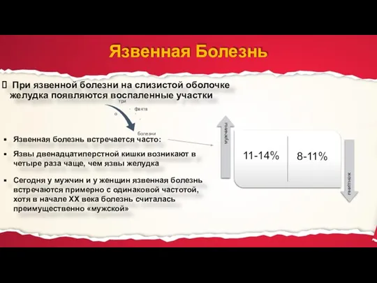 Язвенная Болезнь При язвенной болезни на слизистой оболочке желудка появляются воспаленные участки