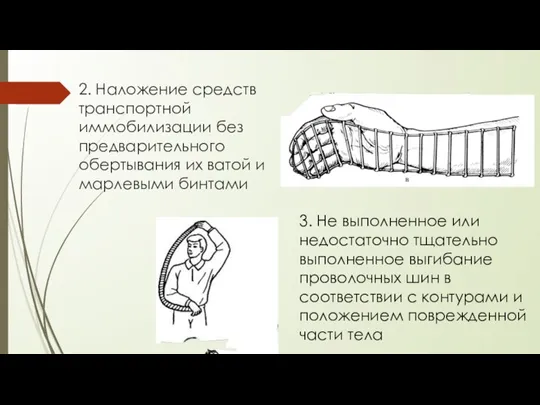 2. Наложение средств транспортной иммобилизации без предварительного обертывания их ватой и марлевыми