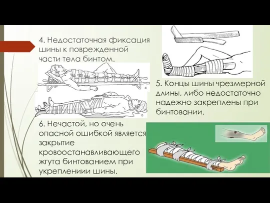 4. Недостаточная фиксация шины к поврежденной части тела бинтом. 5. Концы шины