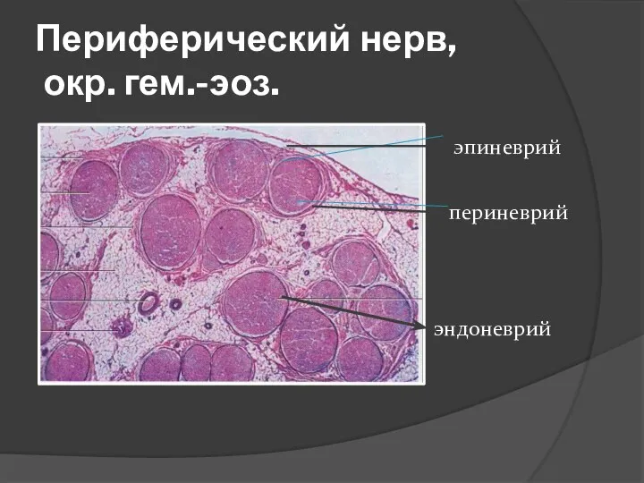 Периферический нерв, окр. гем.-эоз. эндоневрий периневрий эпиневрий