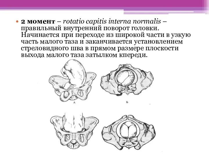 2 момент – rotatio capitis interna normalis – правильный внутренний поворот головки.