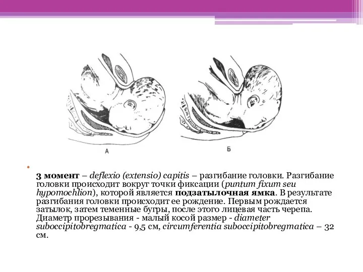 3 момент – deflexio (extensio) capitis – разгибание головки. Разгибание головки происходит