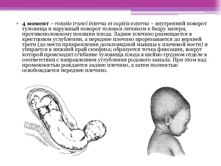 4 момент – rotatio trunci interna et capitis externa – внутренний поворот