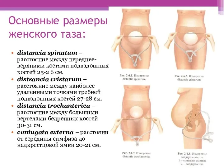 Основные размеры женского таза: distancia spinatum – расстояние между переднее-верхними костями подвздошных