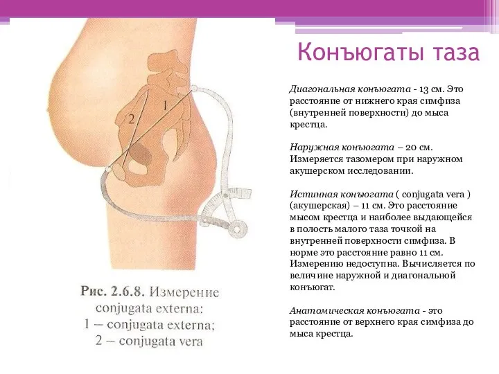 Конъюгаты таза Диагональная конъюгата - 13 см. Это расстояние от нижнего края