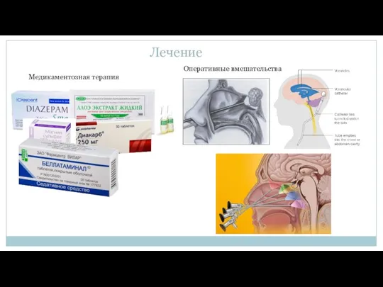 Лечение Медикаментозная терапия Оперативные вмешательства