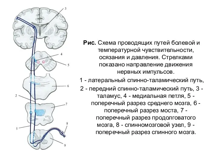 Рис. Схема проводящих путей болевой и температурной чувствительности, осязания и давления. Стрелками